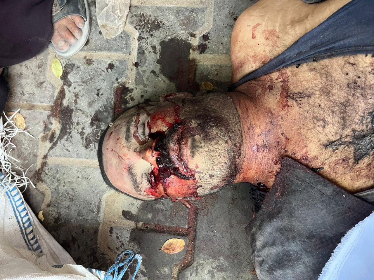 3 Martyrs of unidentified in Al -Shifa Hospital, from the awaits of death, the vicinity