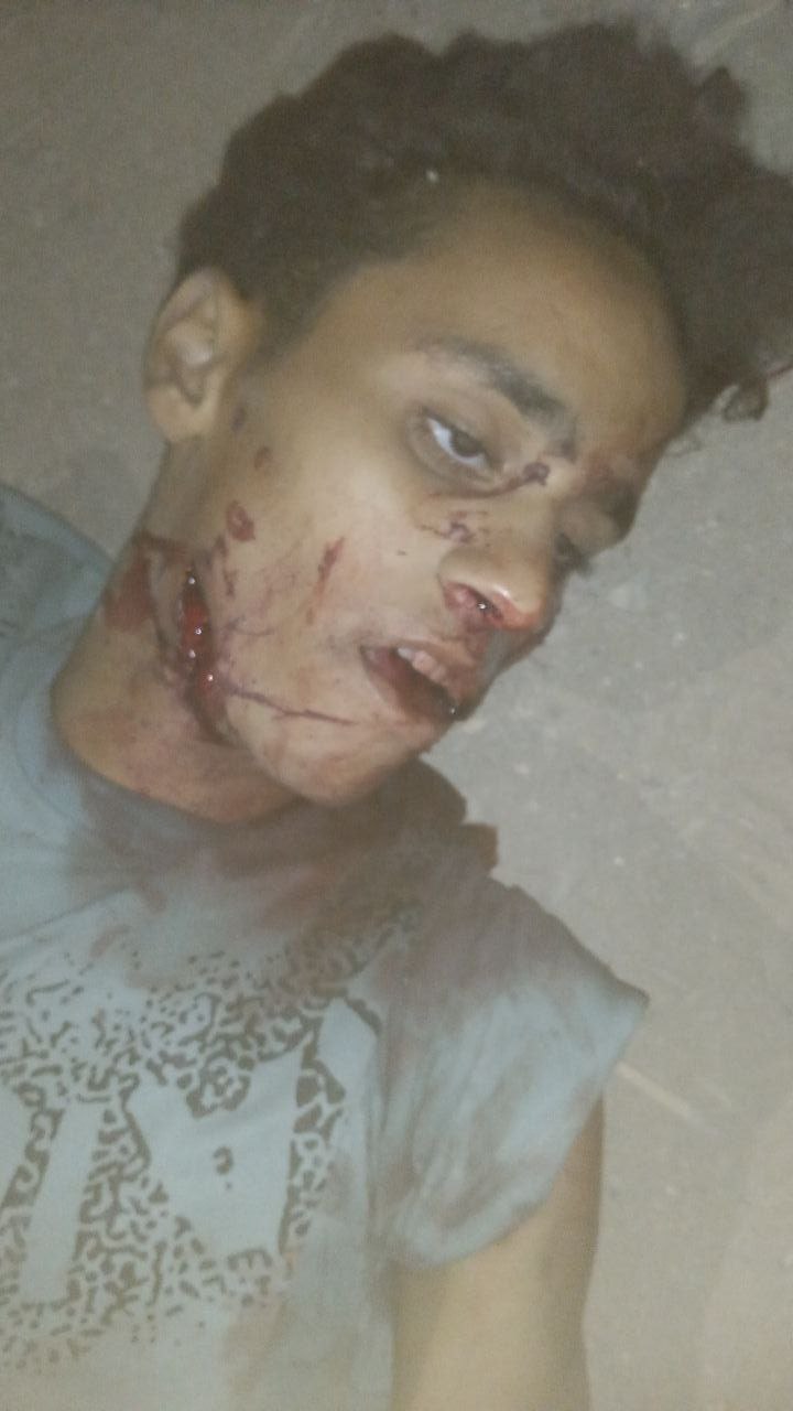 An unidentified martyr was at the junction of the Qasr Al -Adl Street from the direction of the sea,
