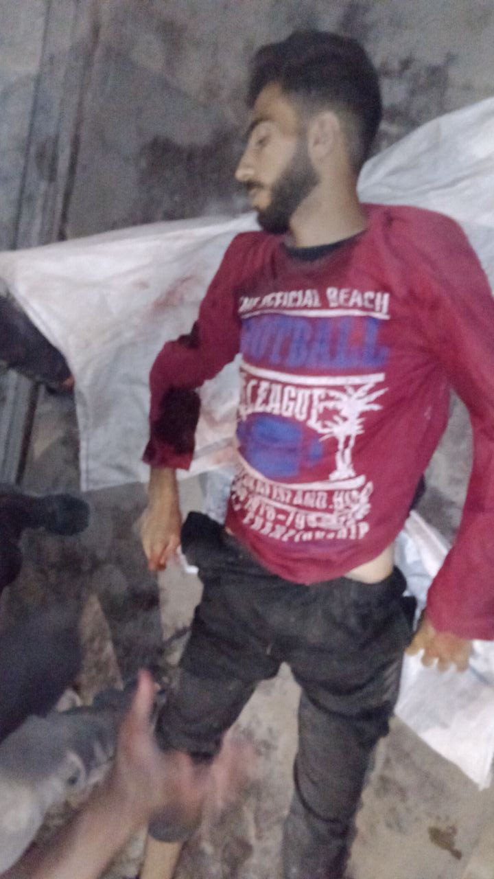 An unidentified martyr was erected from the Nabulsi area, and he is now in the Red Crescent Hospital