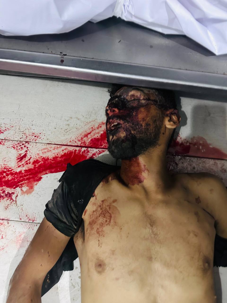 Pictures | Unidentified martyrs are in the morgue of the Nasser Medical Complex