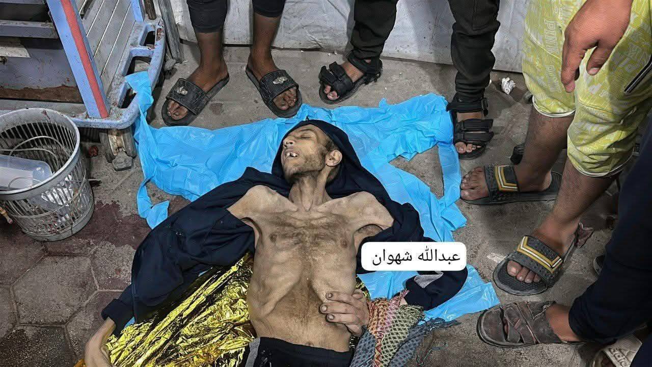 The martyrdom of the citizen Muhammad Al -Sawafiri due to famine in the Gaza Strip