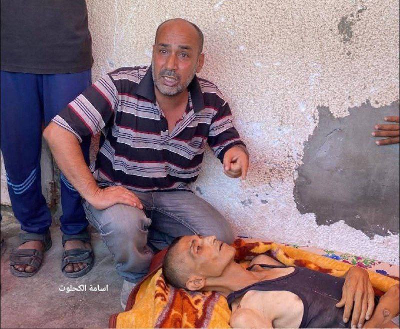 The Palestinian Ahmed Al -Hasanat raises a martyr as a result of the famine that strikes the Gaza St