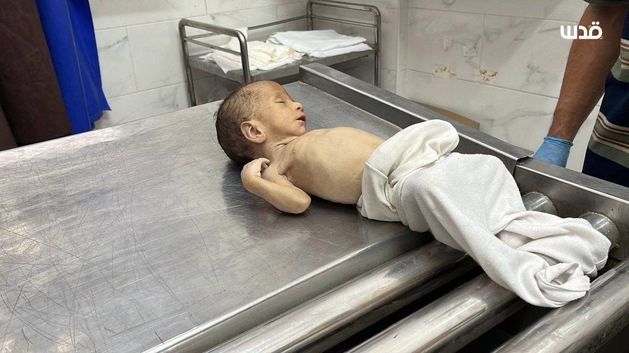 Urgent martyrs of children shortly in the Gaza Strip due to famine