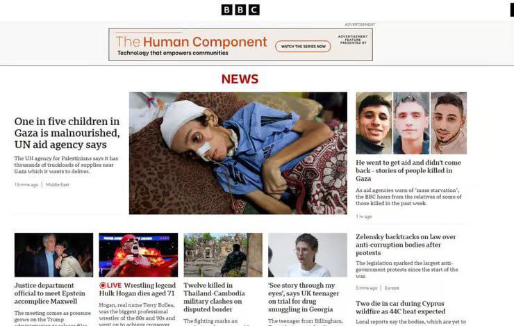 BBC: A child out of every five children in Gaza suffers from malnutrition
