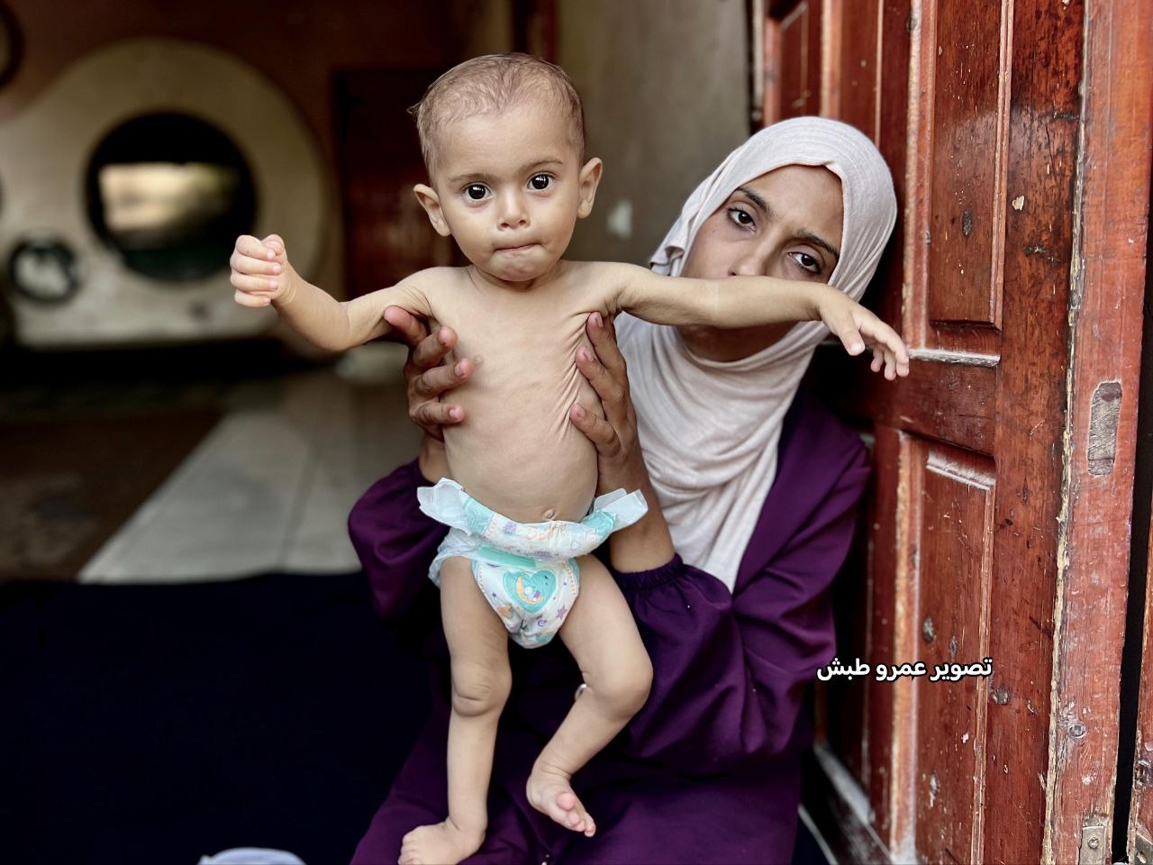 The infant child, "Tin Al -Nada", was born in the war after her father was martyred with Israeli bom