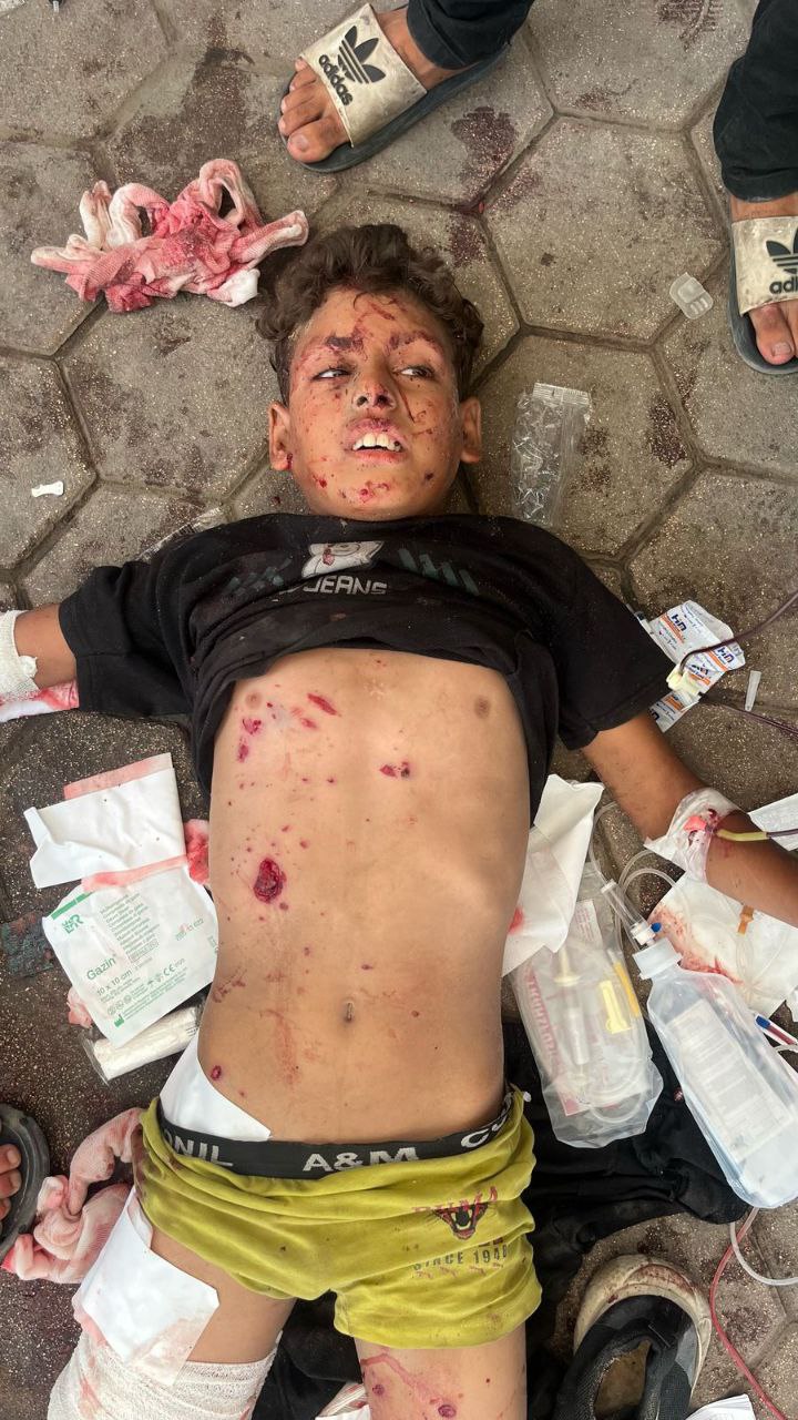 The injured child: Ibrahim Labad is in Al -Ma’dani Hospital, where he was injured in death assistanc