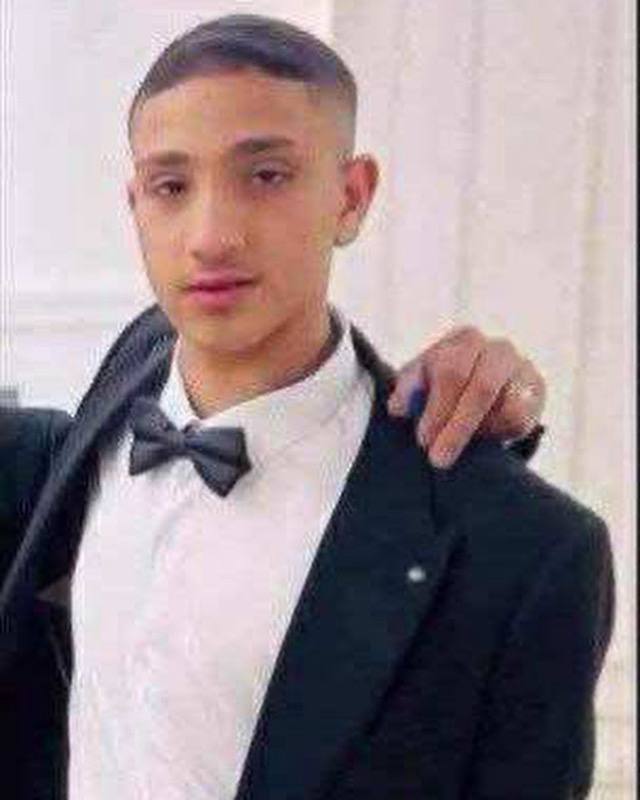 Health: The martyrdom of the child Mohamed Khaled Hassan Mabrouk (14 years old) was severely affecte
