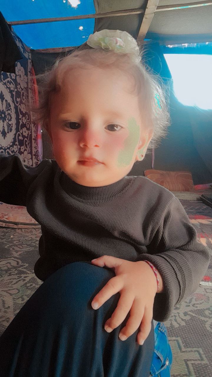 The child, Shams Muhammad Hassanein, was lost two hours ago, a year and a half, when symbolized by u