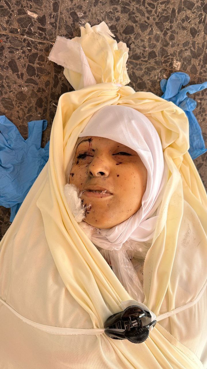 An unidentified martyr from an Israeli bombing targeting the Al -Zaytoun neighborhood in Gaza City l