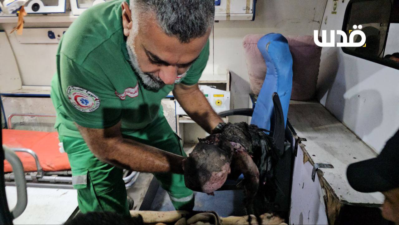 A harsh scene .. A baby was burned by the bombing of the occupation planes as a house in the vicinit