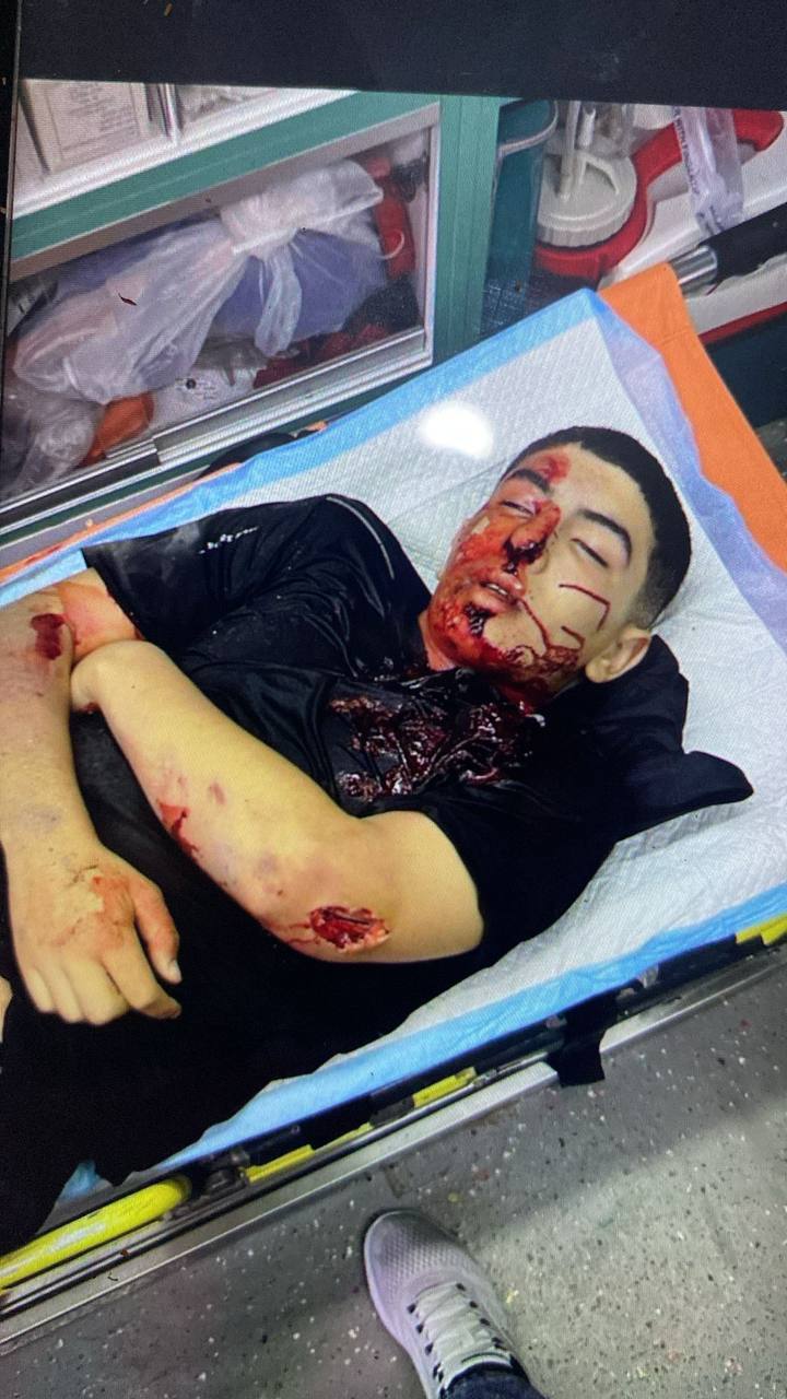 The body of the martyr Amr Ali Qabha, who was elevated by the occupation bullets in the town of Ya`b