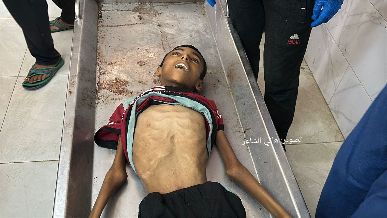 Urgent The death of the child Abdul Hamid Al -Ghalban (14 years old) from Khan Yunis as a result of