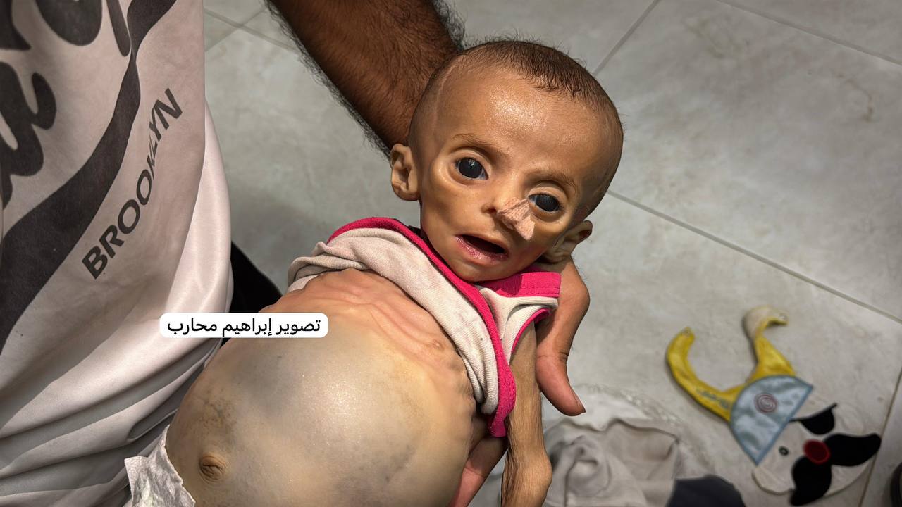 __ The child Zainab Abu Halib (6 months) __ I was martyred in Nasser Hospital affected by acute maln