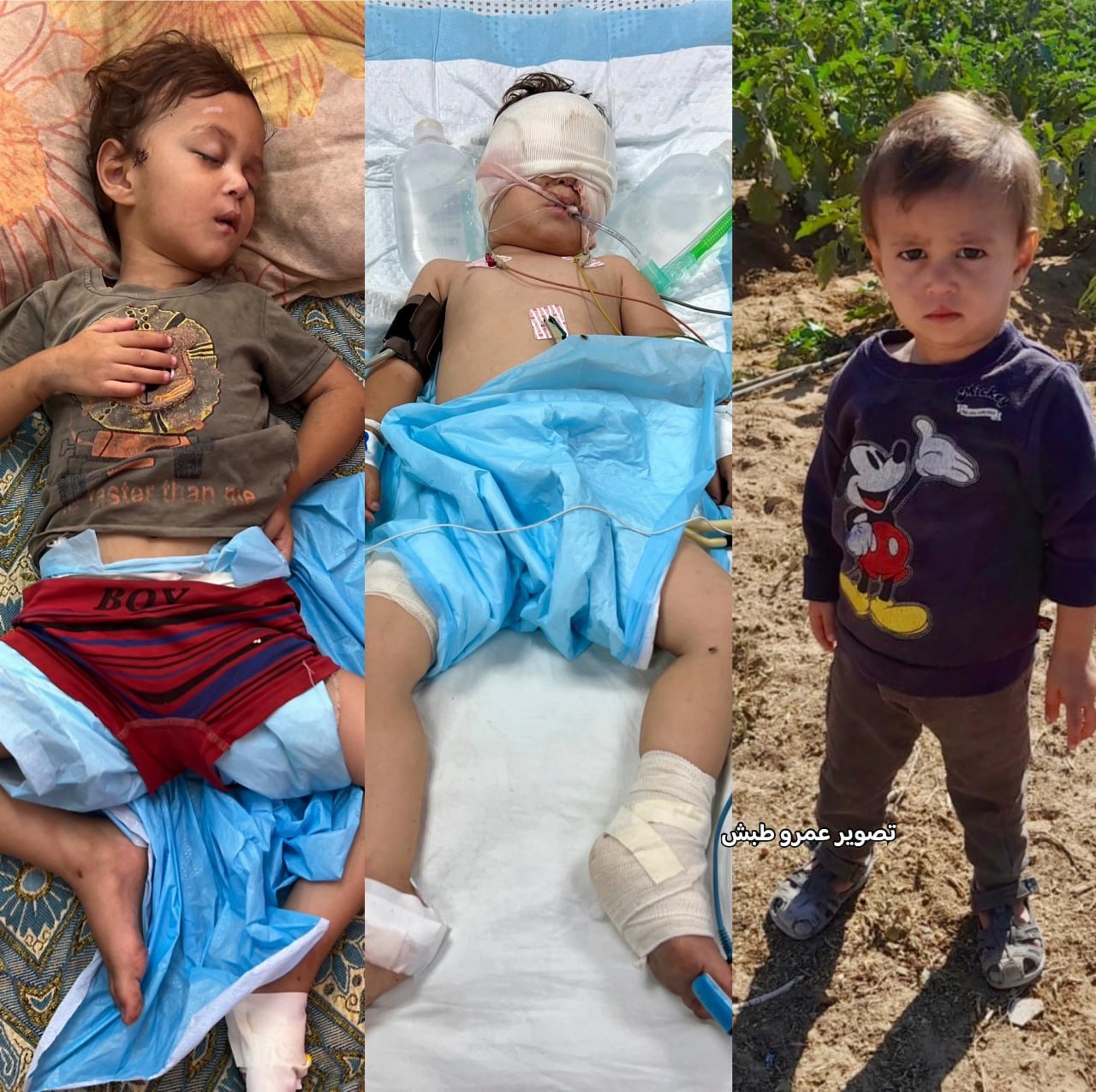 His brothers were martyred and seriously wounded in the "food supplement" massacre .. The child, Sir