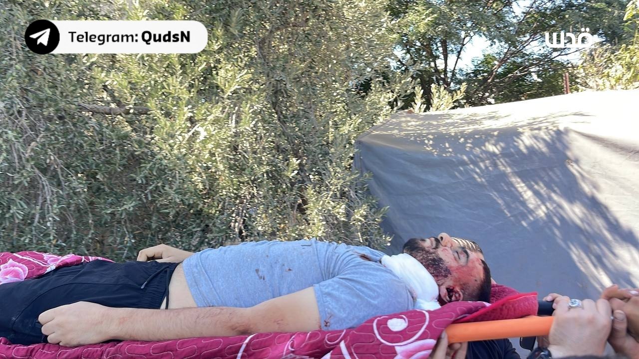 The moment a martyr was transported after being shot dead by the occupation forces, during the siege