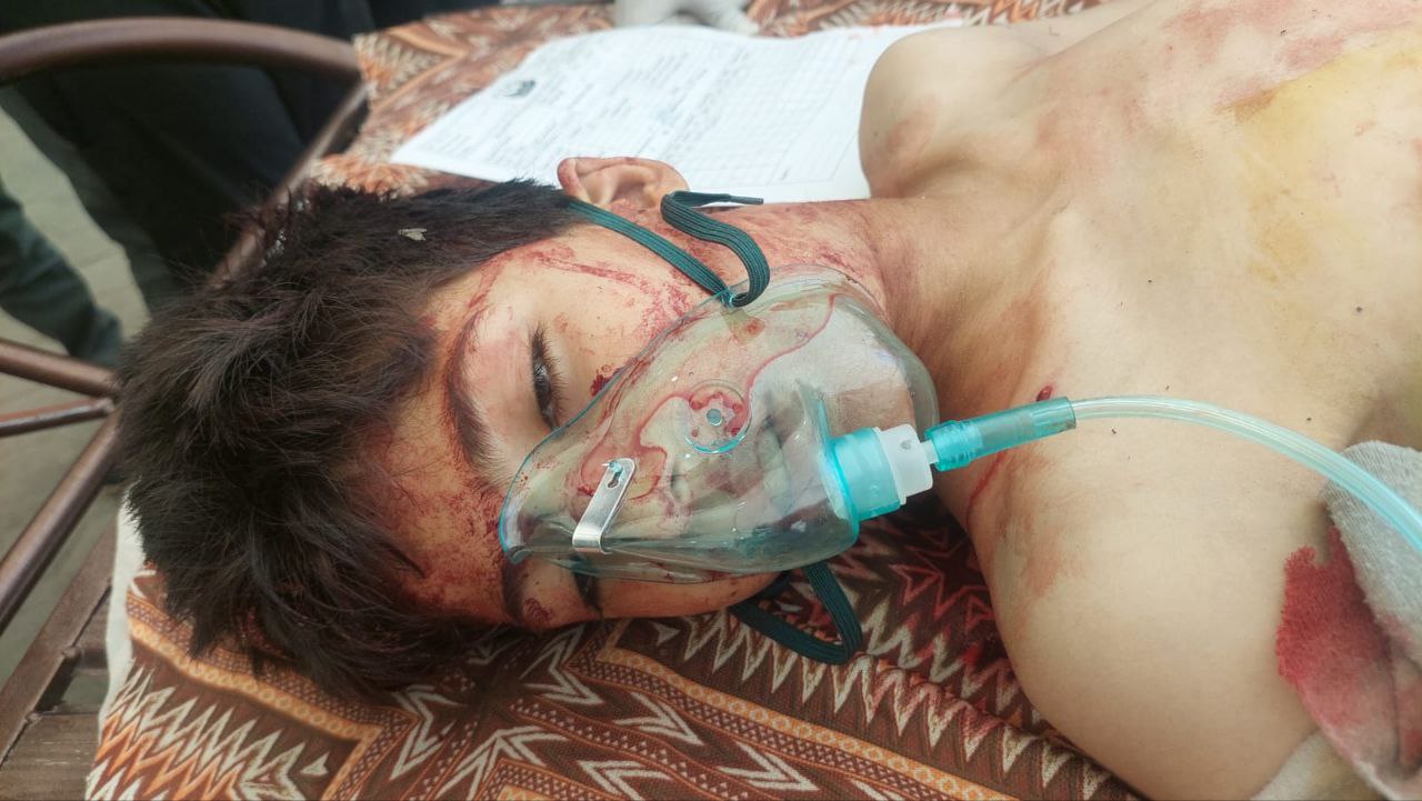 A wounded child was in the Baptist Hospital. No one recognized him and none of his family attended