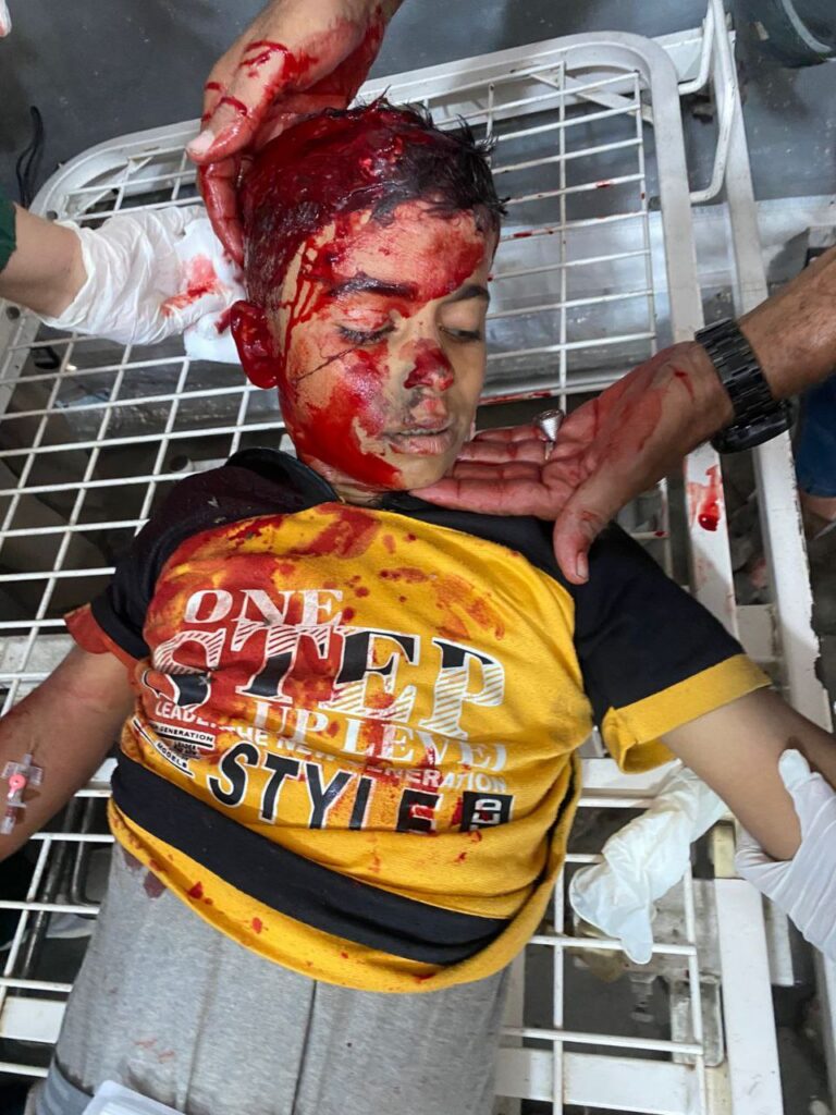 đź”´For publication and circulation, an unidentified injured child in the Ahli Arab Baptist Hospital wa